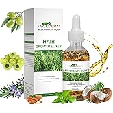 VEGEDERM Hair Growth Elixir | Natural Hair Growth Oil for Scalp & Beard | Hair fall control Serum for Women & Men | Rosemary, Castor Oil, Biotin | Treatment for Longer Hair & Beard | 4.05 Fl Oz