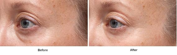 dennis gross triple correction eye serum