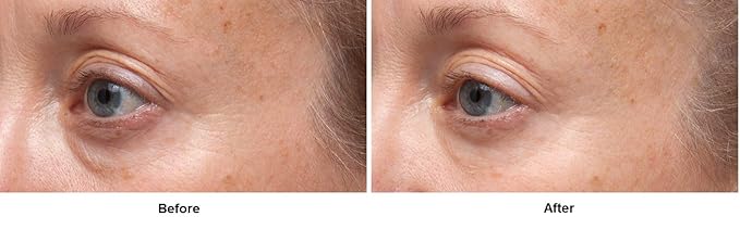 dr dennis gross retinol eye serum review