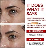 L’Oréal Paris Revitalift Laser Triple Action Day Cream SPF 25 50ml view 2