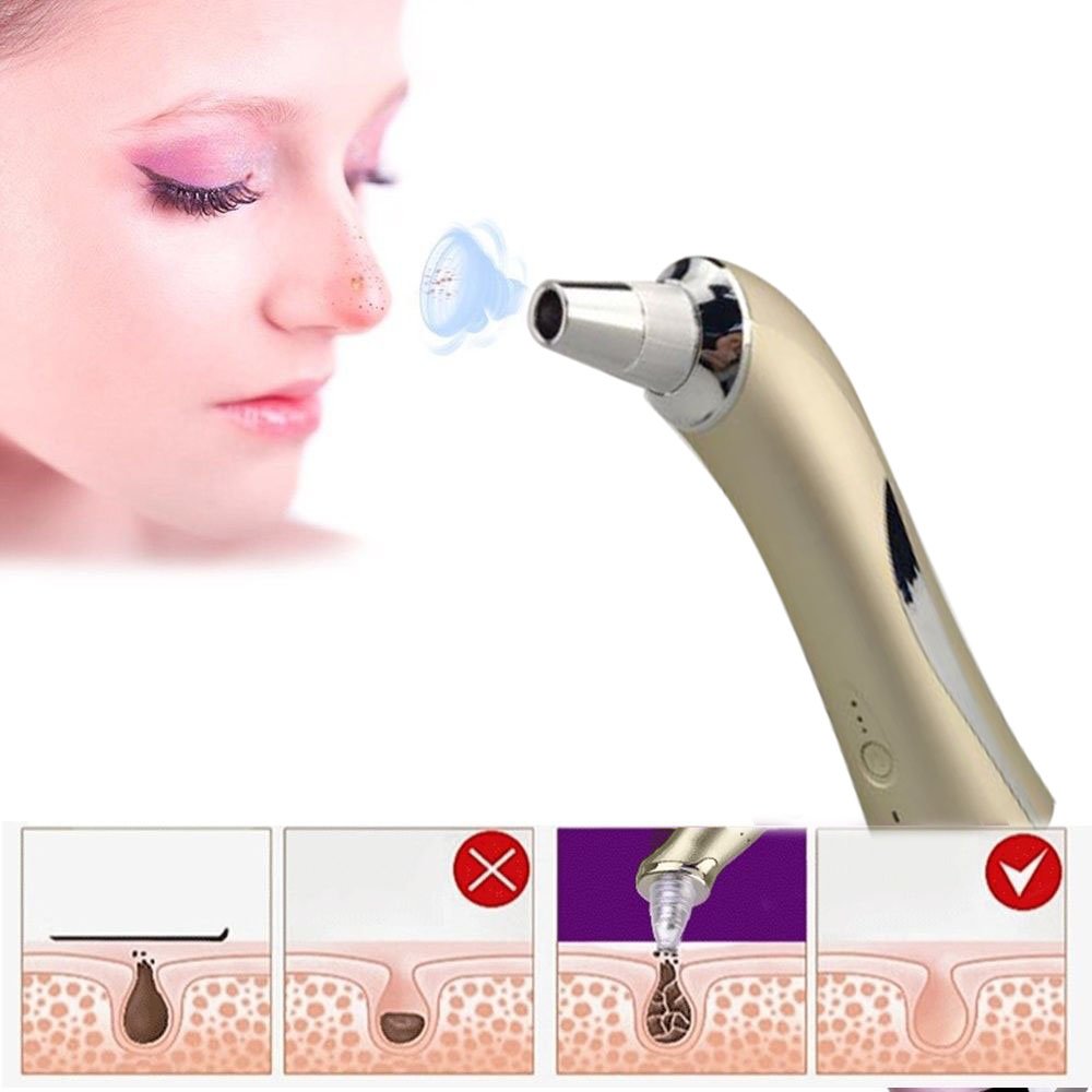 Vinmax Blackhead Suction Remover Portable Skin Peeling Pores Cleaning Blackheads Acne Remover Beauty Machine - Diamond Microdermabrasion Lift Skin Care Device
