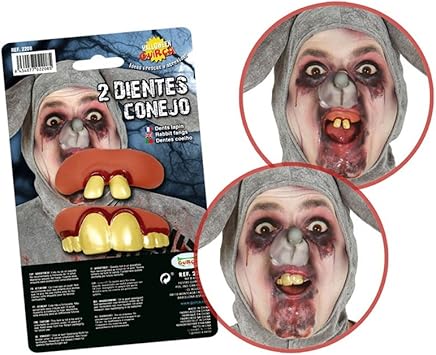 Dentier De Zezette . Complète (Dentier), Partielle, Amovible Sur Implants.