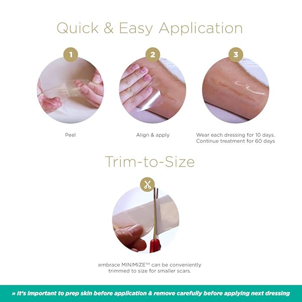 EMBRACE MINIMIZE FOR OLD SCARS, CUT-TO-SIZE LARGE (4.7″) SILICONE SCAR SHEETS, 60 DAY SUPPLY (RECOMMENDED TREATMENT)