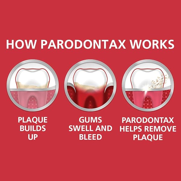 PARODONTAX COMPLETE PROTECTION TOOTHPASTE FOR BLEEDING GUMS, GINGIVITIS TREATMENT AND CAVITY PREVENTION, PURE FRESH MINT – 3.4 OUNCES