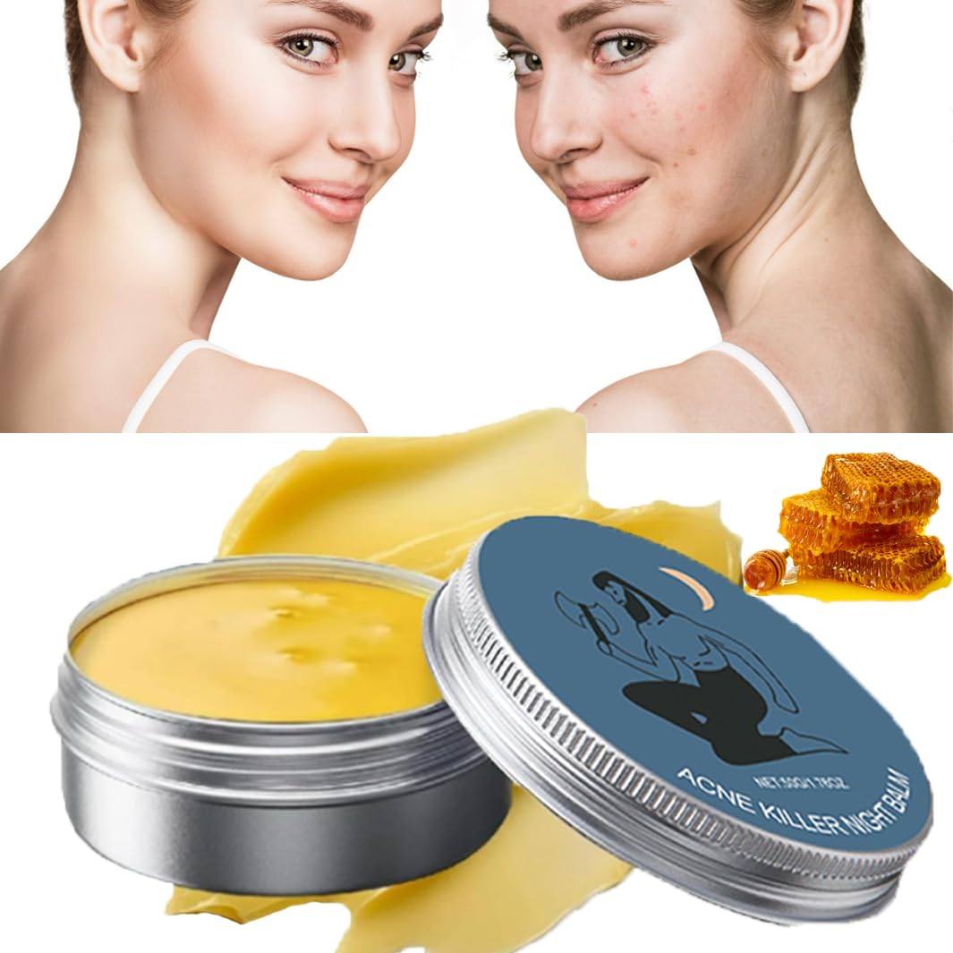 N-orse A-cne O-rganics Balm Cream，N-orse O-rganics A-cne Balm,Organics Acne Killer,Norse Organics Acne & Redness Killer,Norse Acne Set Clearing Cream for