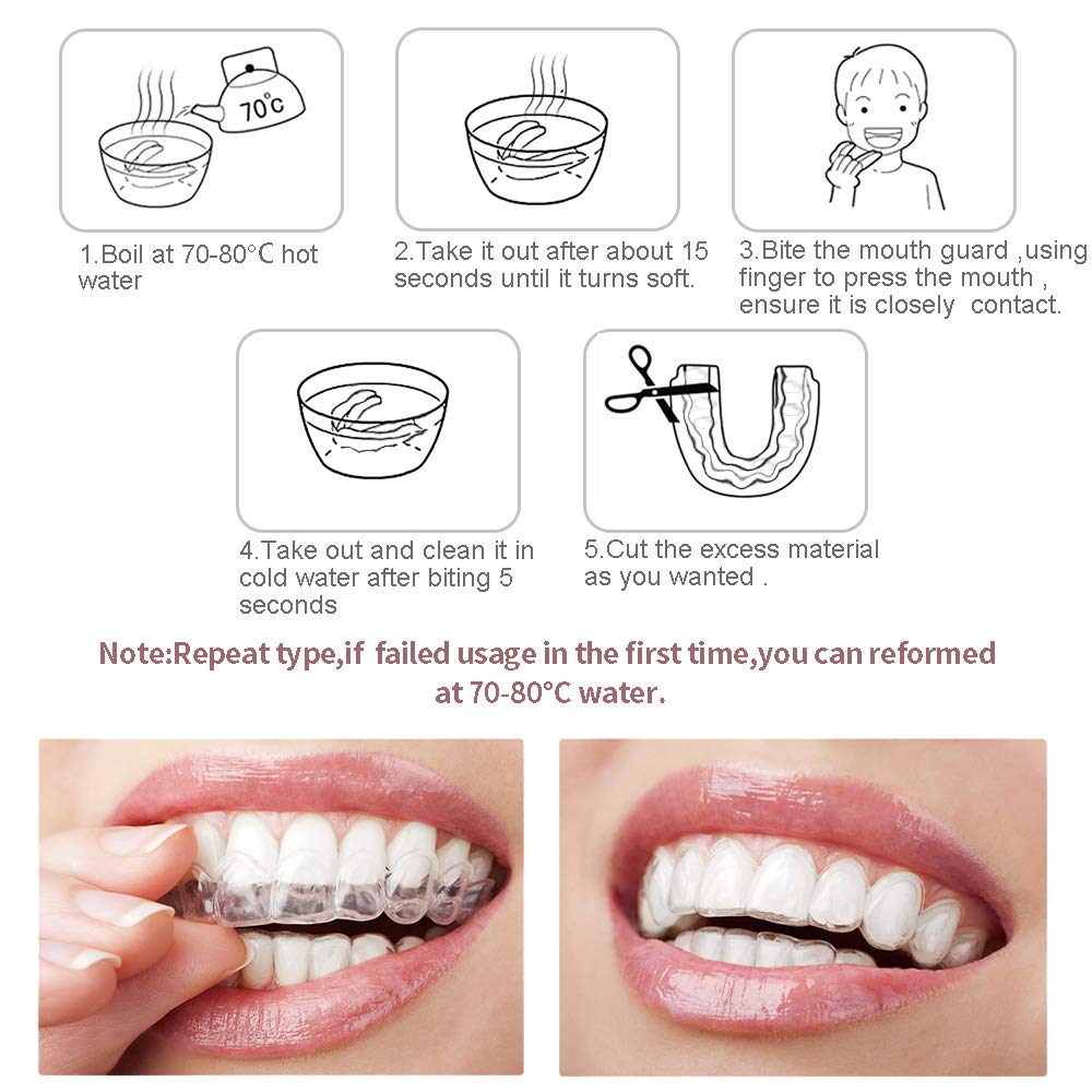 PHOEBE Mouth Guard for Grinding Teeth Night Guards for Teeth Grinding Mouldable Tooth Bite Guard Stop Teeth Grinding Clenching Eliminates Bruxism, TMJ -3 Sizes, 6 Pieces : Beauty