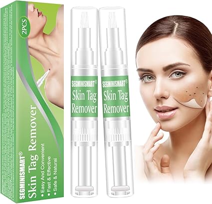 cryotag skin tag remover