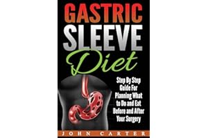 Gastric Sleeve Diet: Step By Step Guide For Planning What to Do and Eat Before and After Your Surgery
