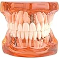 Standard Teaching Teeth Model Removable Typodont Demonstration Disease Study, Orange
