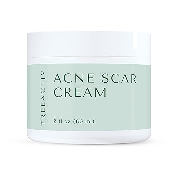 cream for pimple spots on face