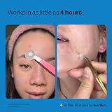 Peach Slices Acne Spot Dots 60ct Hydrocolloid Pimple Patches Face Korean Beauty view 6