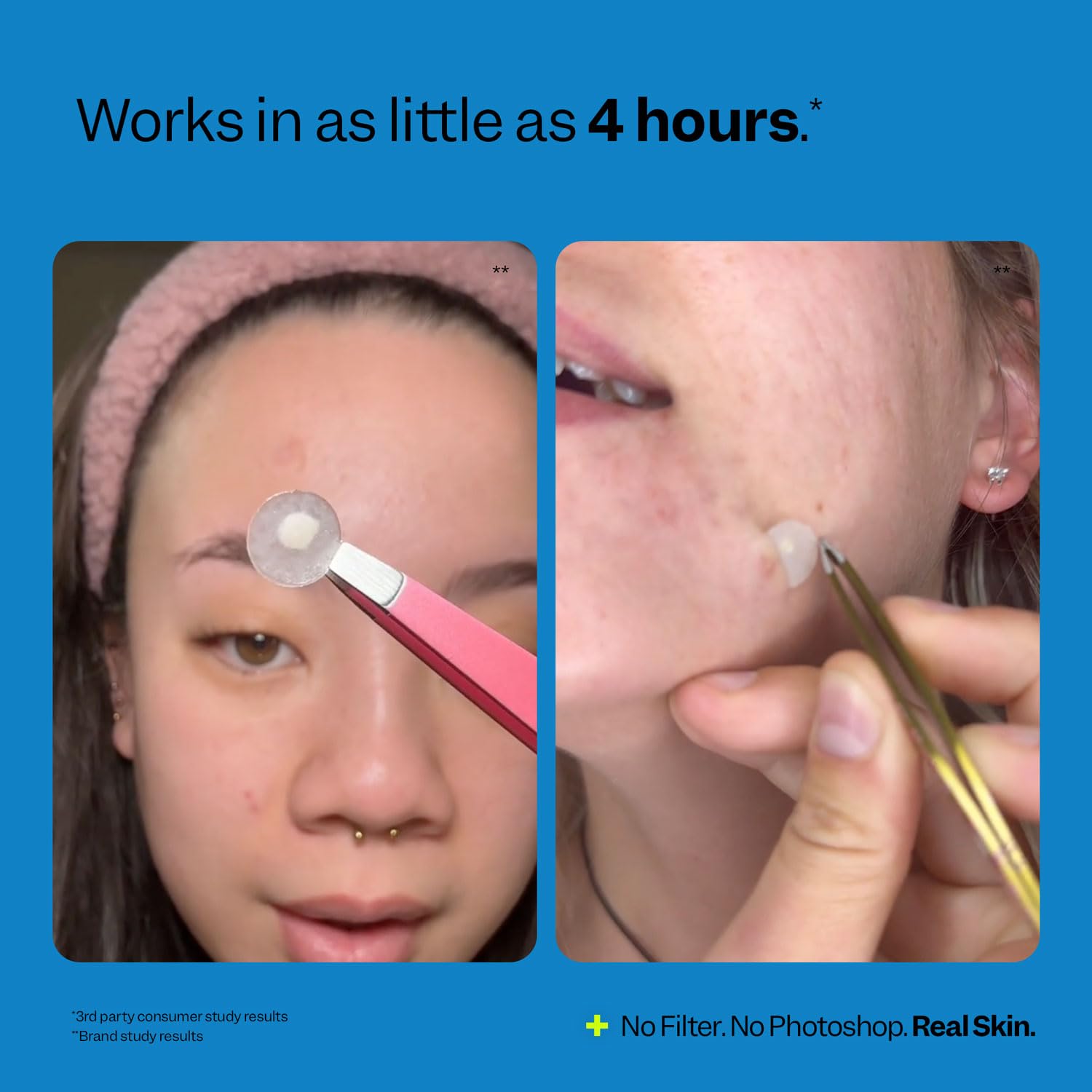 Peach Slices - Acne Spot Dots (30 ct) - Hydrocolloid Pimple Patches for Face - Absorb Gunk, Protect Picking & Support Healing - 3 Sizes (7, 10, & 12mm) - Vegan, Cruelty Free, Korean Skin Care & Beauty