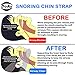 Snoring Solution Anti Snoring Chin Strap Device – Silk Sleep Mask + Strap + 4x Nasal Dilator + Earplugs | 2018 Upgrade Version | Soft & Breathable | Adjustable Size | Anti Bacterial | For Men & Woman