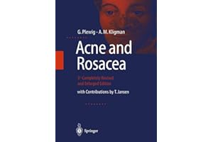 Acne and Rosacea