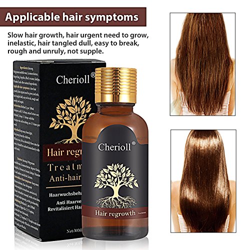 Hair Growth Hair Growth Serum Hair Growth Essence Hair Growth