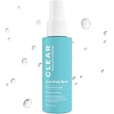 Paula's Choice CLEAR Salicylic Acid Exfoliating Body Acne Spray, 4 Fl Oz | Bacne Spray with 2% BHA, Back Acne Treatment for Clogged Pores, Blackheads &amp; Breakouts, Alcohol-Free, Fragrance-Free