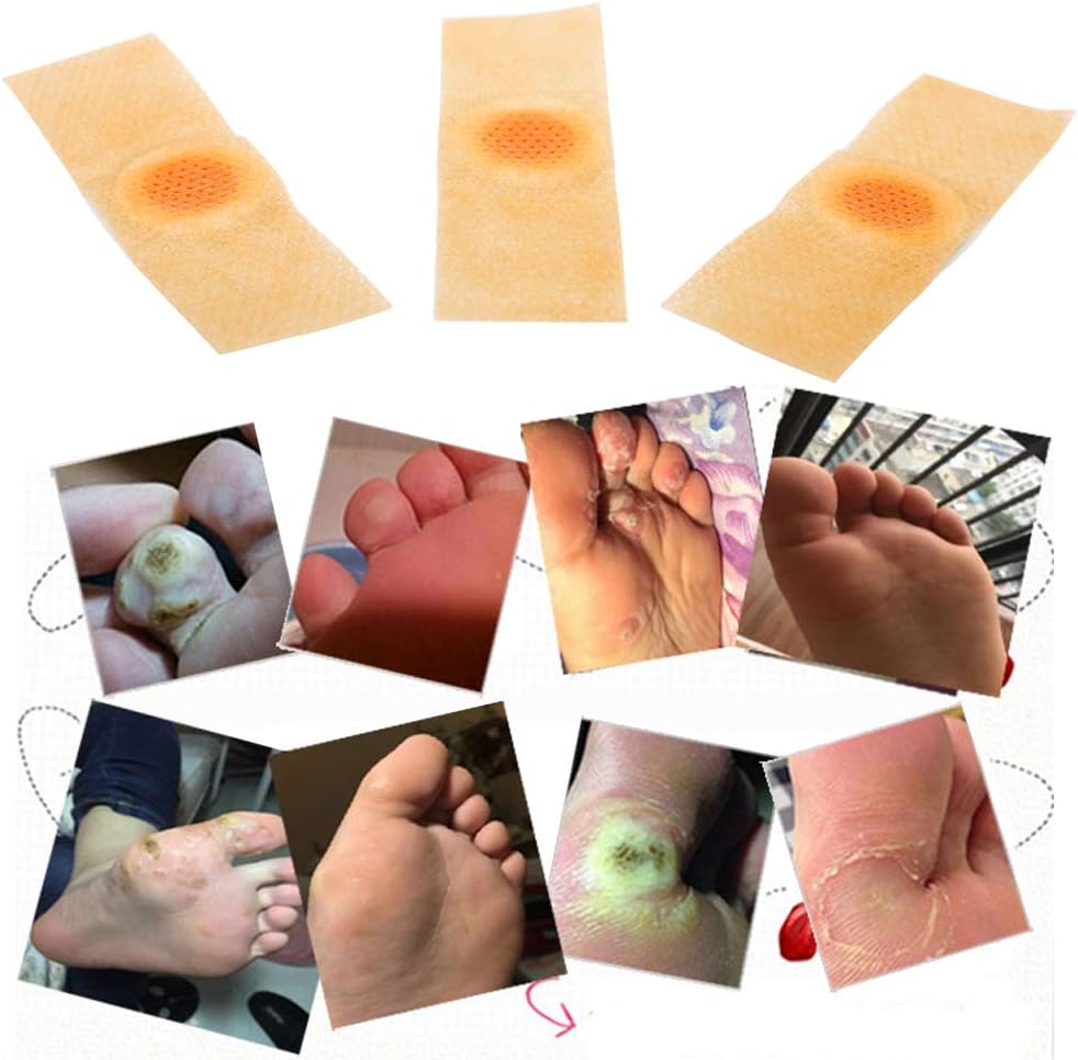 Wart Remover, Wart Removal Plasters Pad, Foot Corn Removal Plaster with Hole, Feet Callus Remove, Soften Skin Cutin Sticker Cure Toe Protector, Relief Pain Removal Warts Plaster 24 Pcs/Box: Health & Personal Care