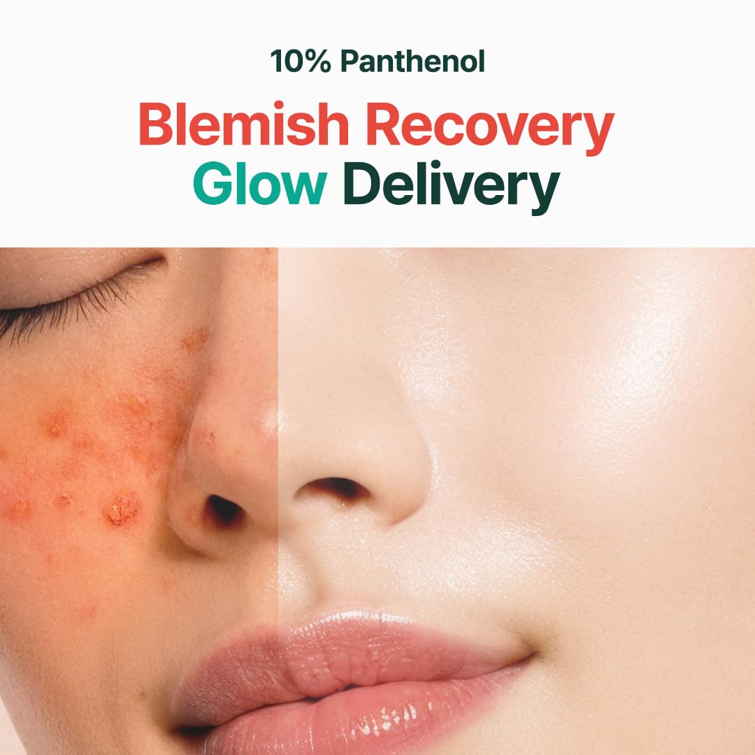 PURITO Panthenol 10% Post-Acne Cream | Moisturizer for Blemish Marks, Barrier Repair | Silicone-Free, Non-Comedogenic, Fragrance-Free, Vegan & Cruelty-free | Korean Skincare, 100mL 3.38 fl.oz 3