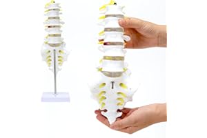 ASINTOD The Lumbar Spine Model, Life-Size Anatomical Model of The Lumbar Spine, Lumbosacral Segment with Nerves and Disc Herniation, Including Display Base