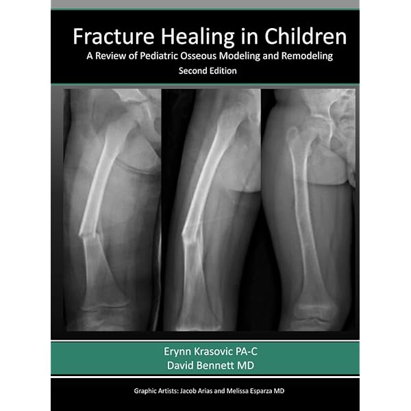 Harborview Illustrated Tips and Tricks in Fracture Surgery