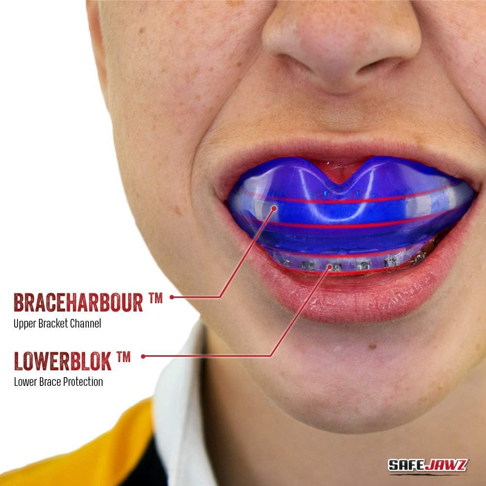 SAFEJAWZ Mouthguard for Braces, One Size Re-Mouldable Mouth Guard with Case for Boxing, Basketball, Football, MMA, Lacrosse, Hockey and All Contact Sports (Ice Blue) : Sports & Outdoors