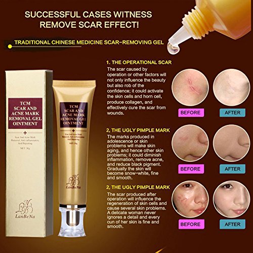 Wisdompark Acne Scar Removal Cream Skin Repair Face Cream Acne Spots