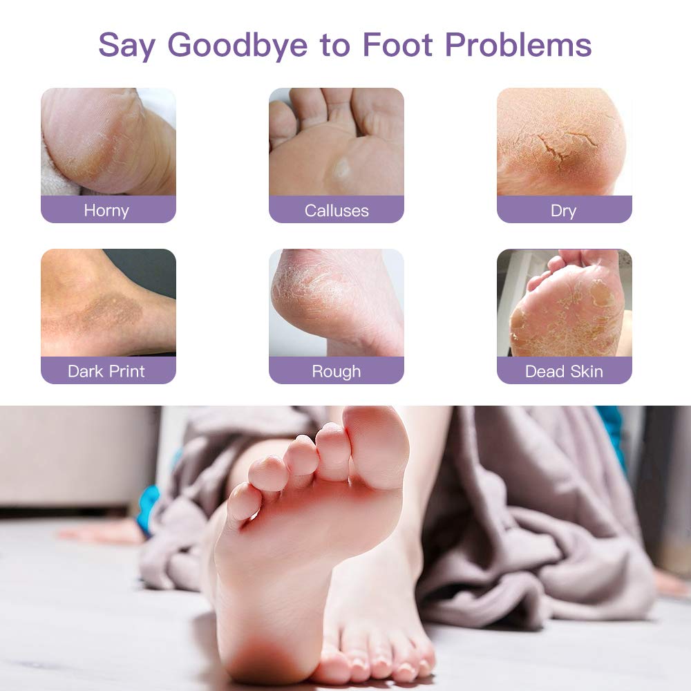 Sonkir Exfoliating Foot Mask, Peeling Away Rough Calluses and Dead Skin cells in 1-2 Weeks, Repair Exfoliant Treatment for Soft Smooth & Healthy Feet (Lavender/2 Pairs)