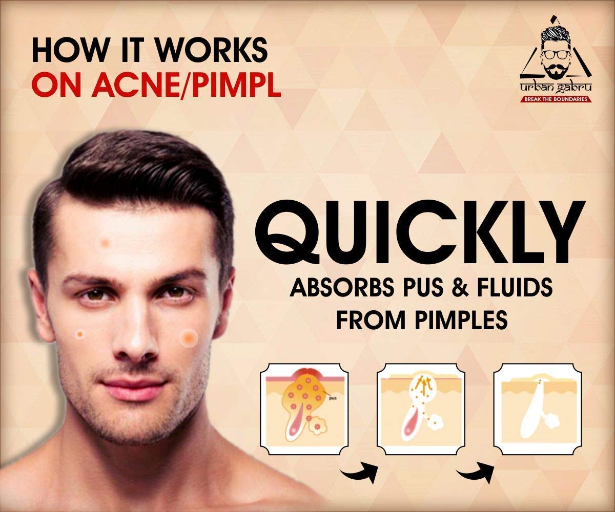urbangabru acne pimple patch