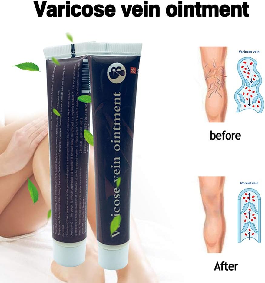 Fairylove Varicose Vein Cream Pure Natural Ingredients Varicose Vein