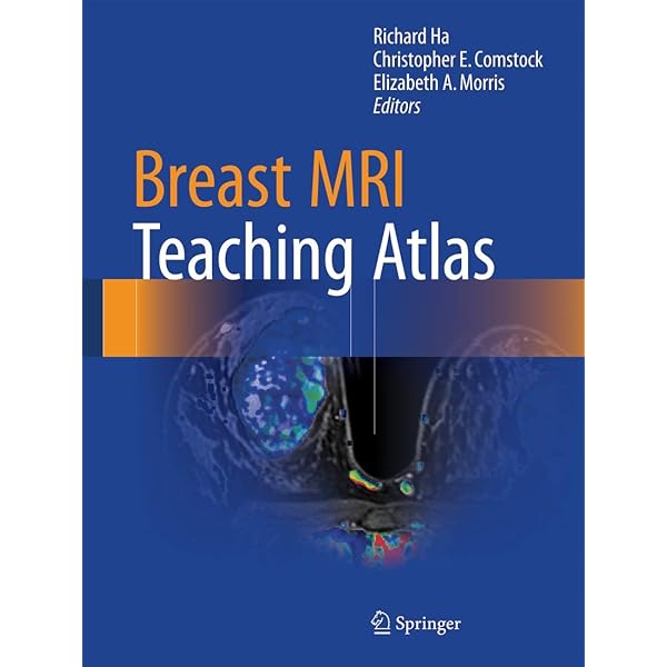健康・医学 Breast Ultrasound A. Thomas Stavros Breast Ultrasound: 9780397516247: Medicine & Health Science