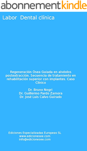 Download Regeneración Ósea Guiada en alvéolos postextracción. Secuencia de tratamiento en rehabilitación superior con implantes. Caso Clínico (Labor Dental Clínica) (Spanish Edition) PDF