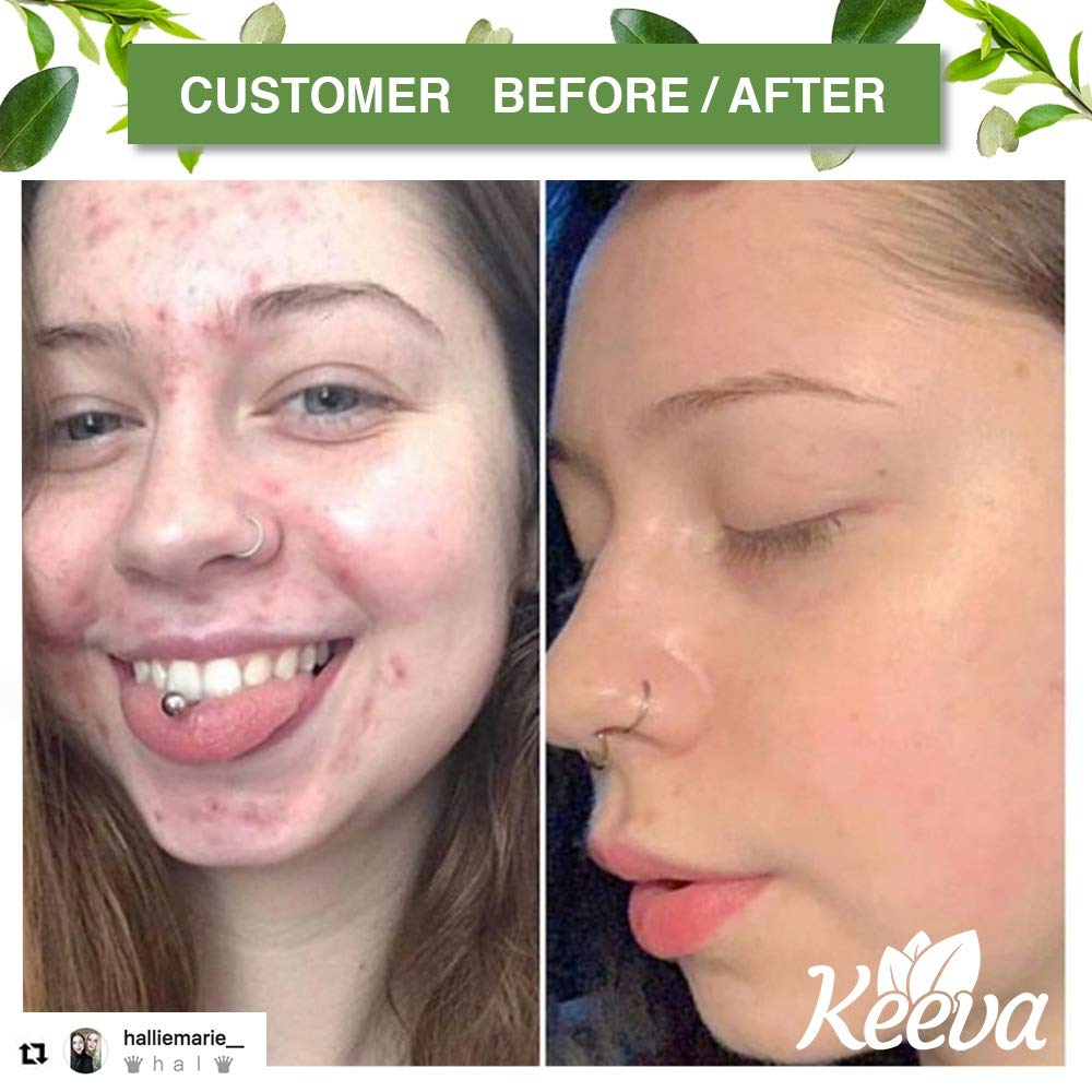 keeva face wash