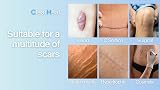 ClearHeal Silicone Scar Sheets 4cm x 1.5m for C-Section Recovery view 4