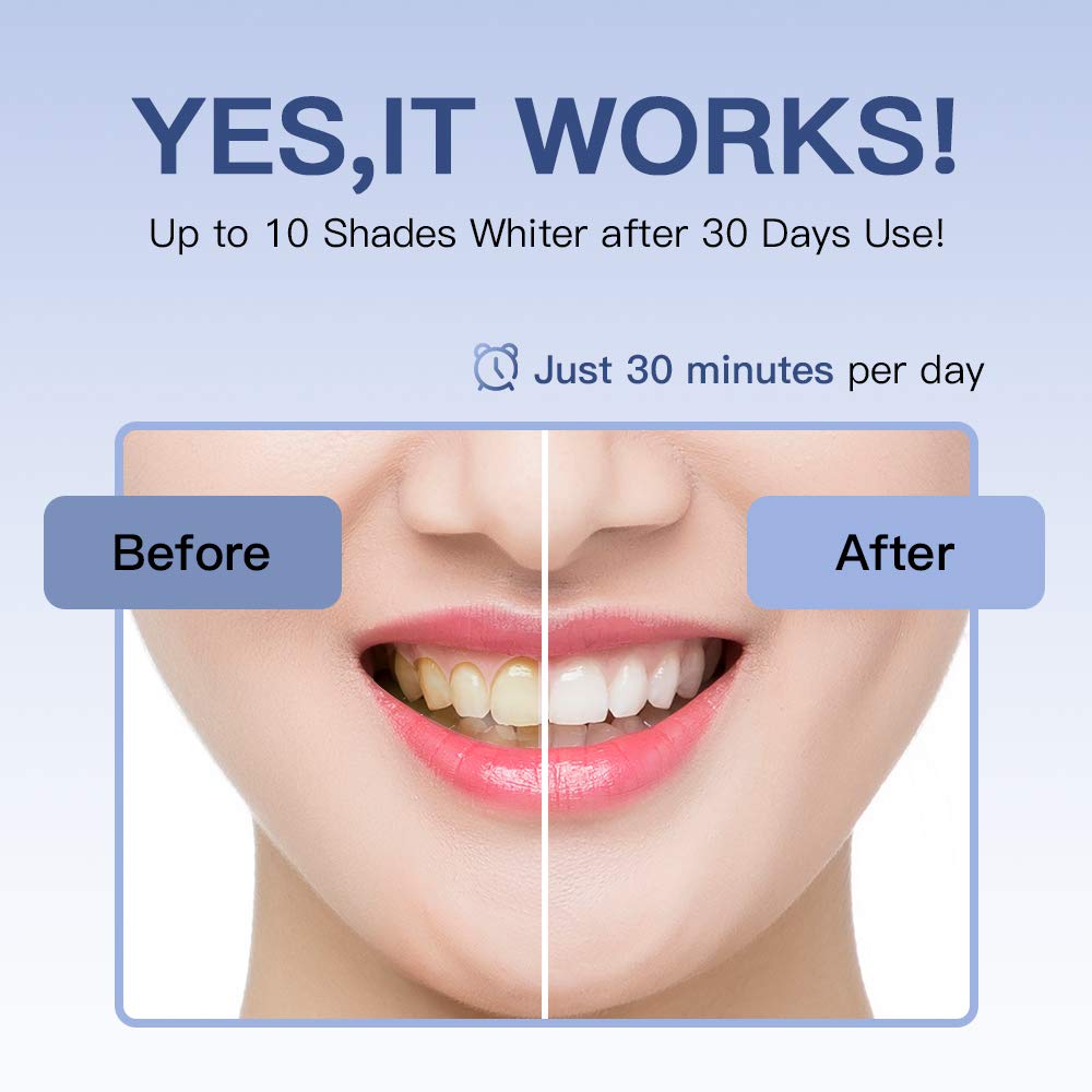 SENSOLOGY Teeth Whitening Kit with Led Light, 16 powerful Teeth Whitener, 35% Carbamide Peroxide Tooth Whitener, (4) 3ml Gel Syringes, Mouth Tray, (5) Whitening Stripes-Built in 7 Types Timer : Beauty