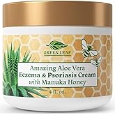 Manuka Honey Eczema Cream Moisturizing Lotion for Psoriasis Relief - Itchy, Dry Skin Rash Ointment - Soothing Moisturizer for Baby, Kids, Adults - High Strength Body & Face Cream 4oz
