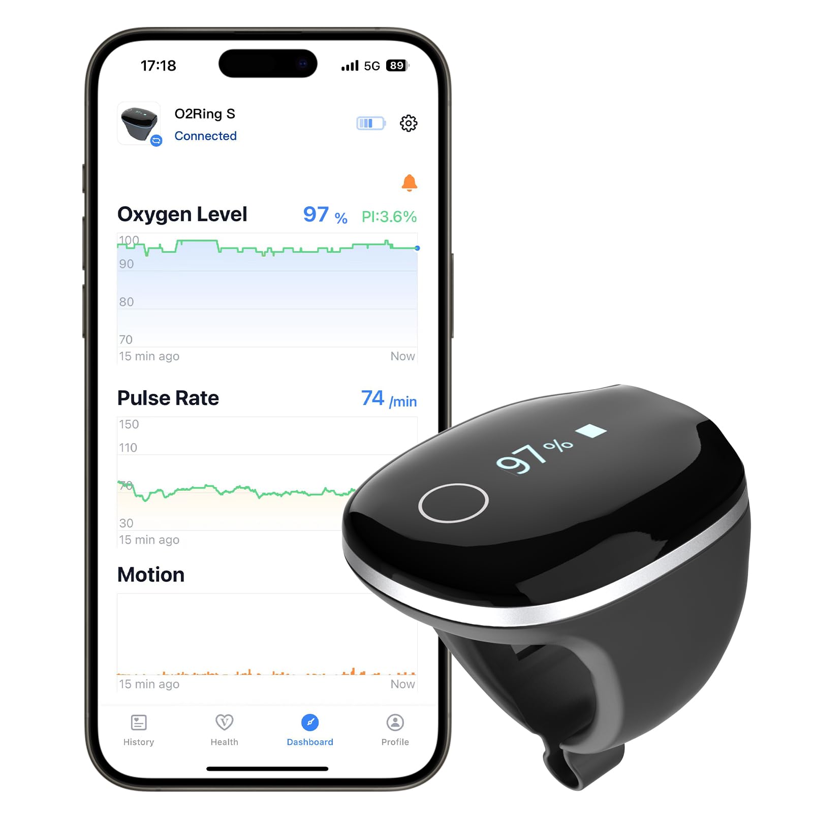 Photo 1 of Wellue O2Ring-S Oxygen Monitor for Small Fingers | Rechargeable Pulse Oximeter, Continuous Blood Oxygen & Pulse Rate Tracking with Vibration Reminder | 24 hrs Battery Life, 4 * 10 Hours Data Storage