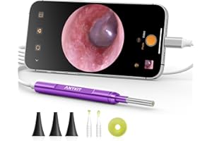 Anykit USB-C Digital Otoscope for Type-C Phone & Tablet, Ultra Clear View Ear Camera with Ear Wax Removal Tools, Video Ear Scope Otoscope with Light, Support Capture Photo & Record Videos (Purple)