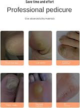 BROLEO Rechargeable Foot File Callus Remover - Dead Skin Remover, Ergonomic view 4
