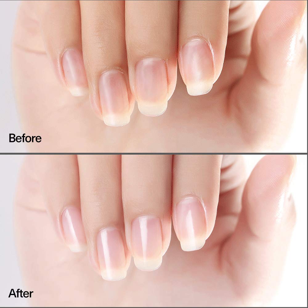 Modelones Nail Strengthener Nail Treatment for Chipping, Peeling, Brittle Fingernails, Strengthens, Conditions, Nail Hardener Use as a Top Coat or Base Coat, 0.5 fluid oz : Beauty
