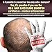 DCKR Natural Clinic Shampoo RGIII - Best Organic Red Ginseng Ingredients for Anti-Hair Loss & Regeneration - Patented Hair Care Shampoo RG III