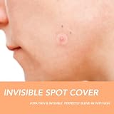 Aliobio Invisible Spot Cover Hydrocolloid Patches 216 Count Two Sizes view 3