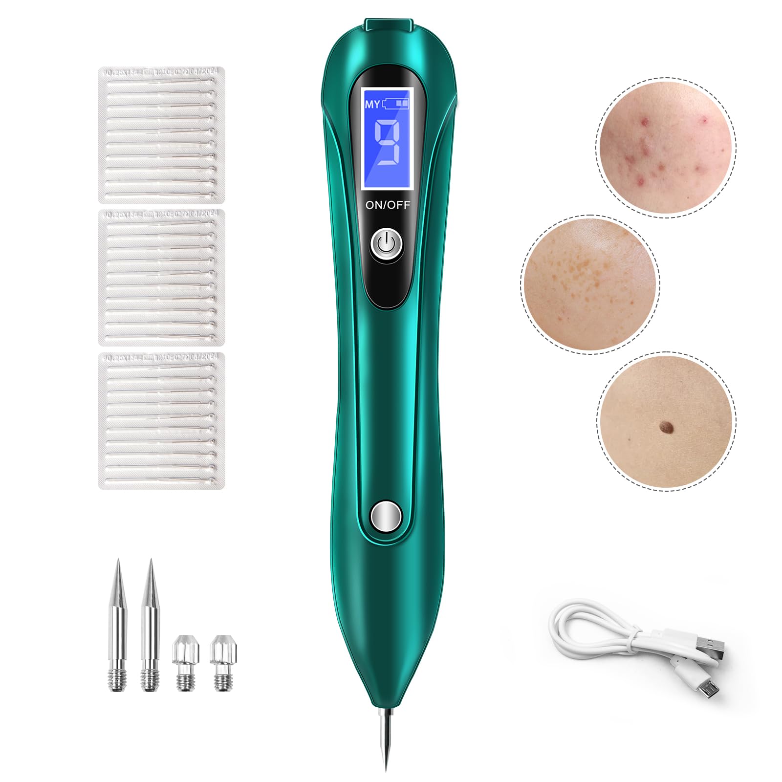 CHRERNA Skin- Tag -Remover Pen, Mole Kit Removal Kit with 9 Strength Levels, Plasma Pen for Body Face Home Use Tag Buddy Beauty Tool Set (Green)