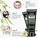 Vassoul Blackhead Remover Mask, Deep Pore Cleansing for Face Nose Acne Treatment Oil Control (50g)