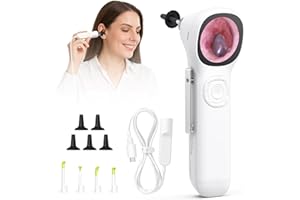 ScopeAround Otoscope with Light, 720P HD Ear Cleaning Camera & 6 LED Lights Ear Scope, 1.45" IPS Display Digital Otoscope, Ear Scope with Extention Cable, Smart Ear Camera, Ready to Use White