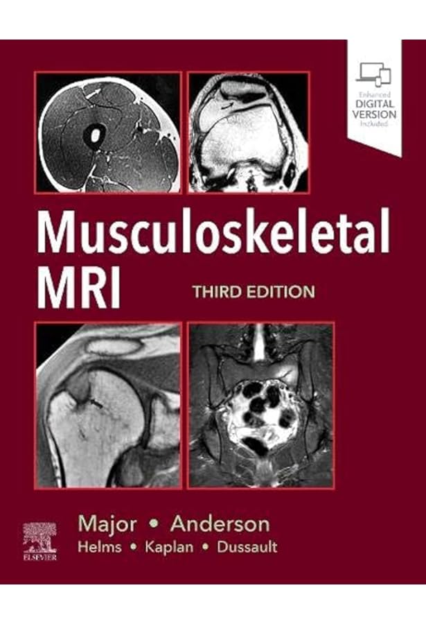 Diagnostic Imaging: Musculoskeletal Non-Traumatic Disease