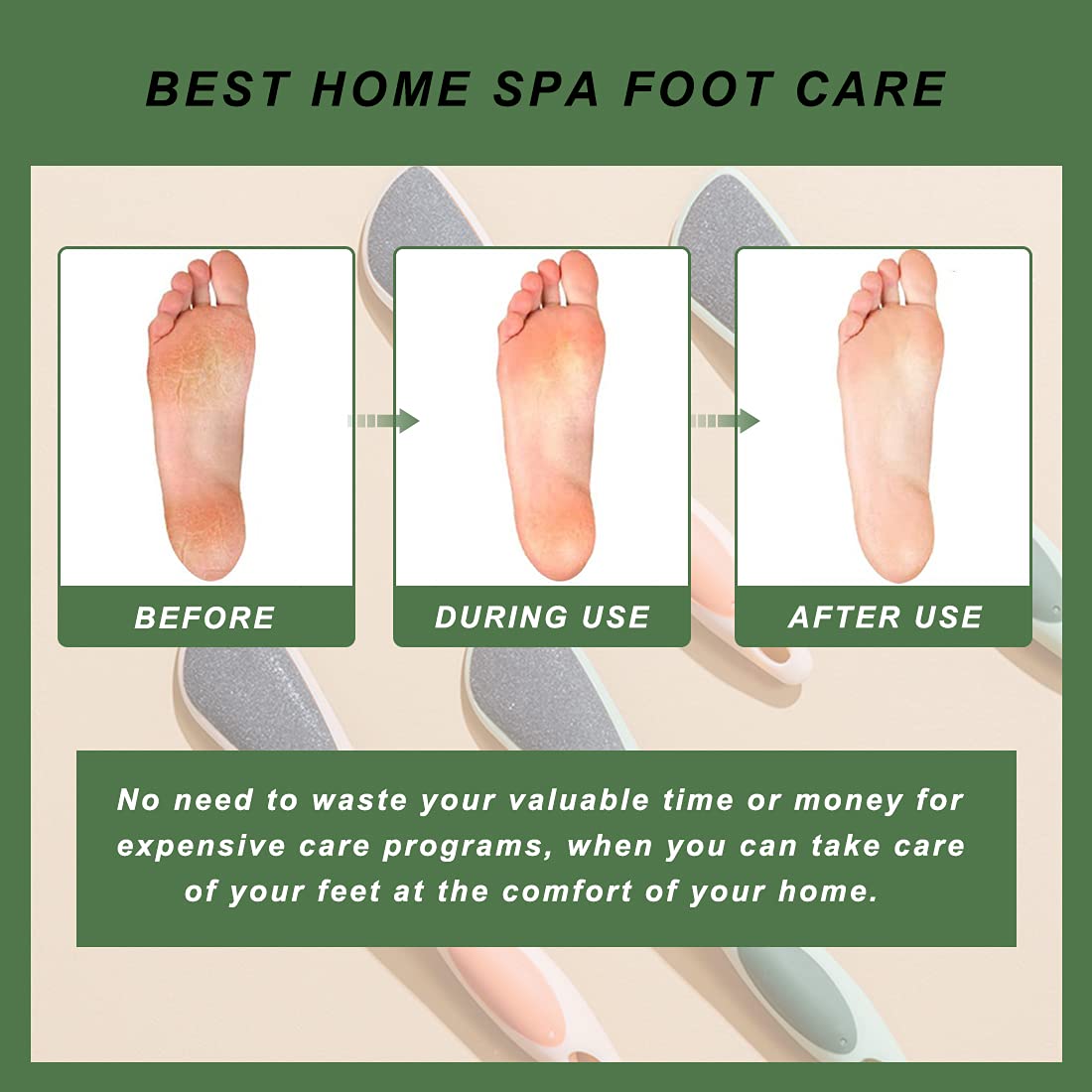 KLLENAKIY Double Sided Foot Pumice Stone, Feet Pumice Scrubber with Handle, Relieve Foot Fatigue and Stress, Suitable for Home Foot Care (Green): Beauty