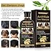 Hair Growth Shampoo,Anti-Hair Loss Shampoo,Hair Loss shampoo,Ginger Hair Care Shampoo Helps Stop Hair Loss,Promotes Thicker,Fuller and Faster Growing Hair for Men & Womenthumb 2