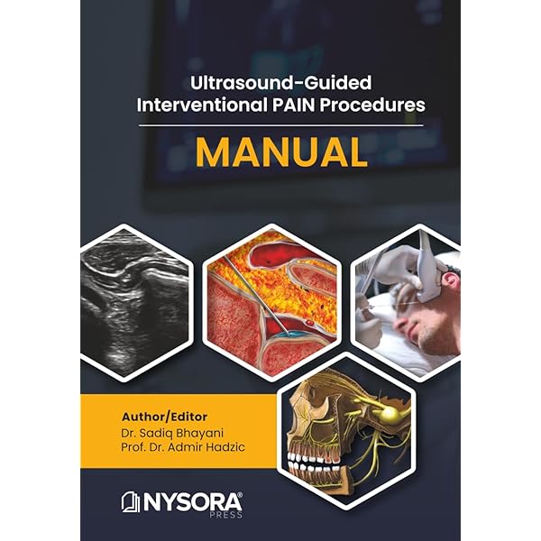 健康・医学 HADZIC'S PERIPHERAL NERVE BLOCKS 4155B4akAgL._AC_UF1000,