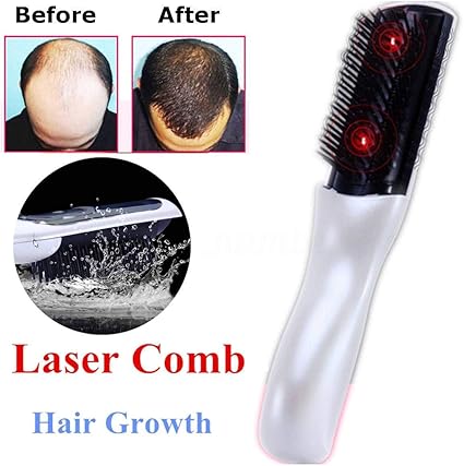 Amazon Co Jp Sooger Electric Scalp Brush Wireless Infrared Laser Sonic Vibrating Magnetic Battery Operated Thin Scalp Care Prevents Hair Loss Accelerates Hair Growth Electric Hair Comb Anti Shedding Therapeutic Massager Hair Regeneration