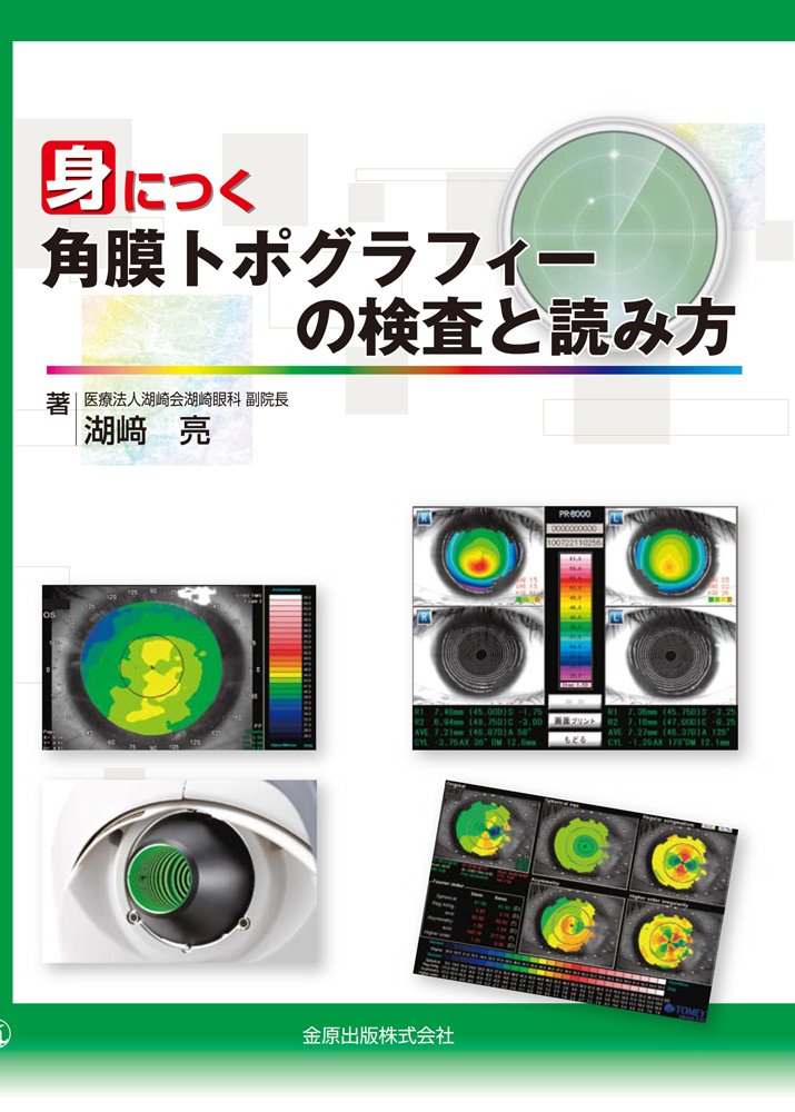 Amazon Co Jp 身につく角膜トポグラフィーの検査と読み方 湖崎 亮 本